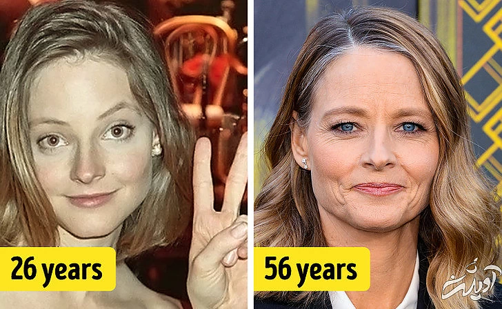 چهره‌های معروفی که هیچ جراحی زیبایی نکرده‌اند